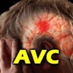 Antes de você sofrer um AVC o seu corpo vai dar os seguintes sinais preste atenção, fique atento a esses sintomas