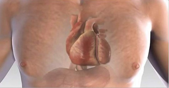 Um mês antes de você sentir um ataque cardíaco seu corpo vai dar sinais e aqui estão os 9 sinais que você deve se preocupar